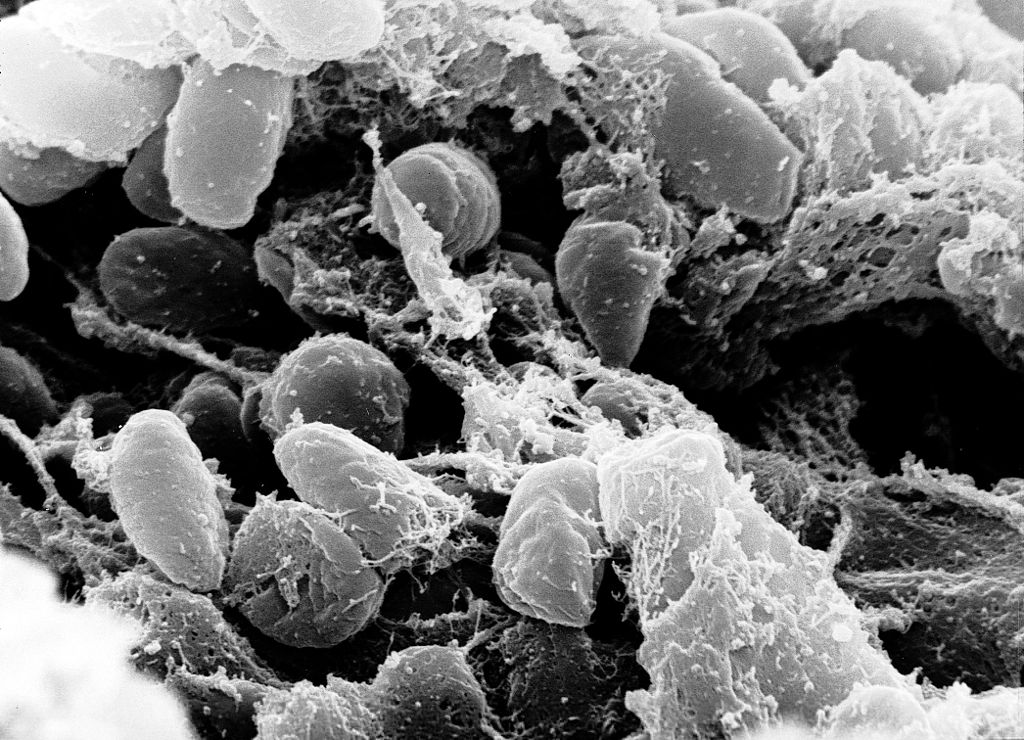 Yersinia pestis that causes the Bubonic plague