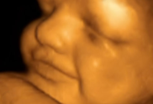 Photo of unborn taken by ultrasound in 24 weeks
